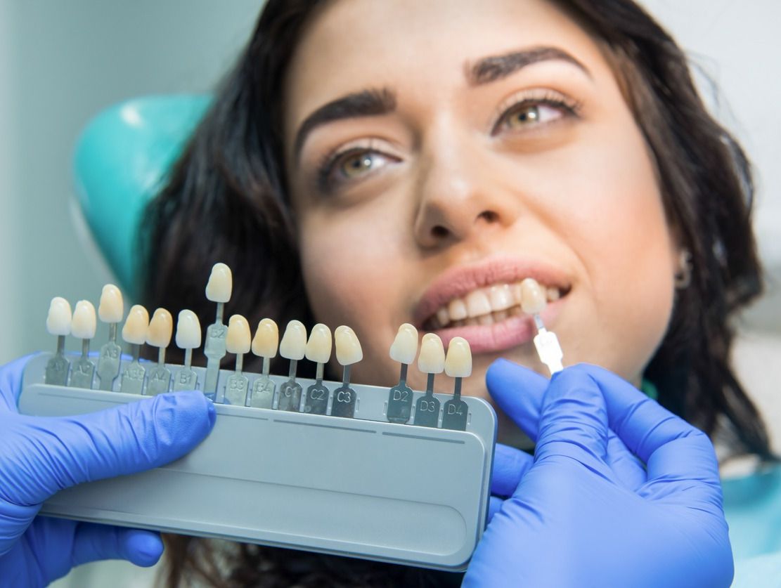 chica en dentista blanqueamiento