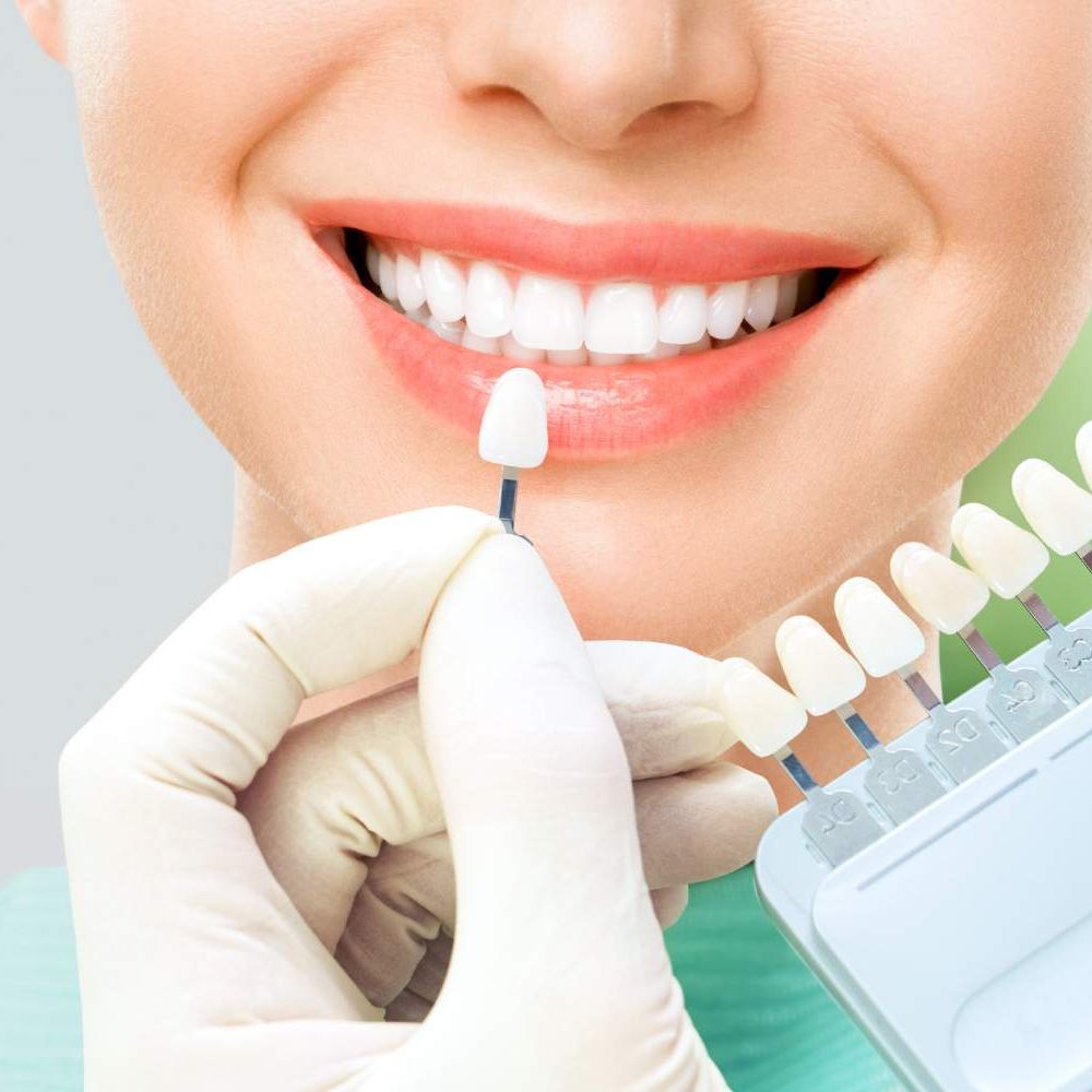 verifique-seleccione-color-dientes-blanqueamiento-dientes1